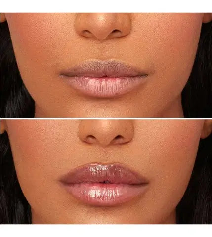 Voluminizador de Labios 2x1